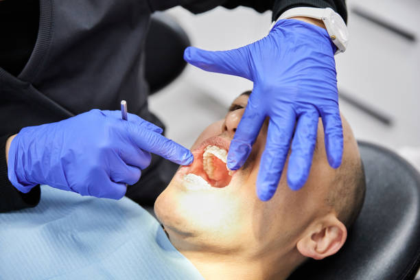 Best Emergency Dentist for Lost Fillings or Crowns in Balmville, NY
